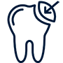 Composite Bonding